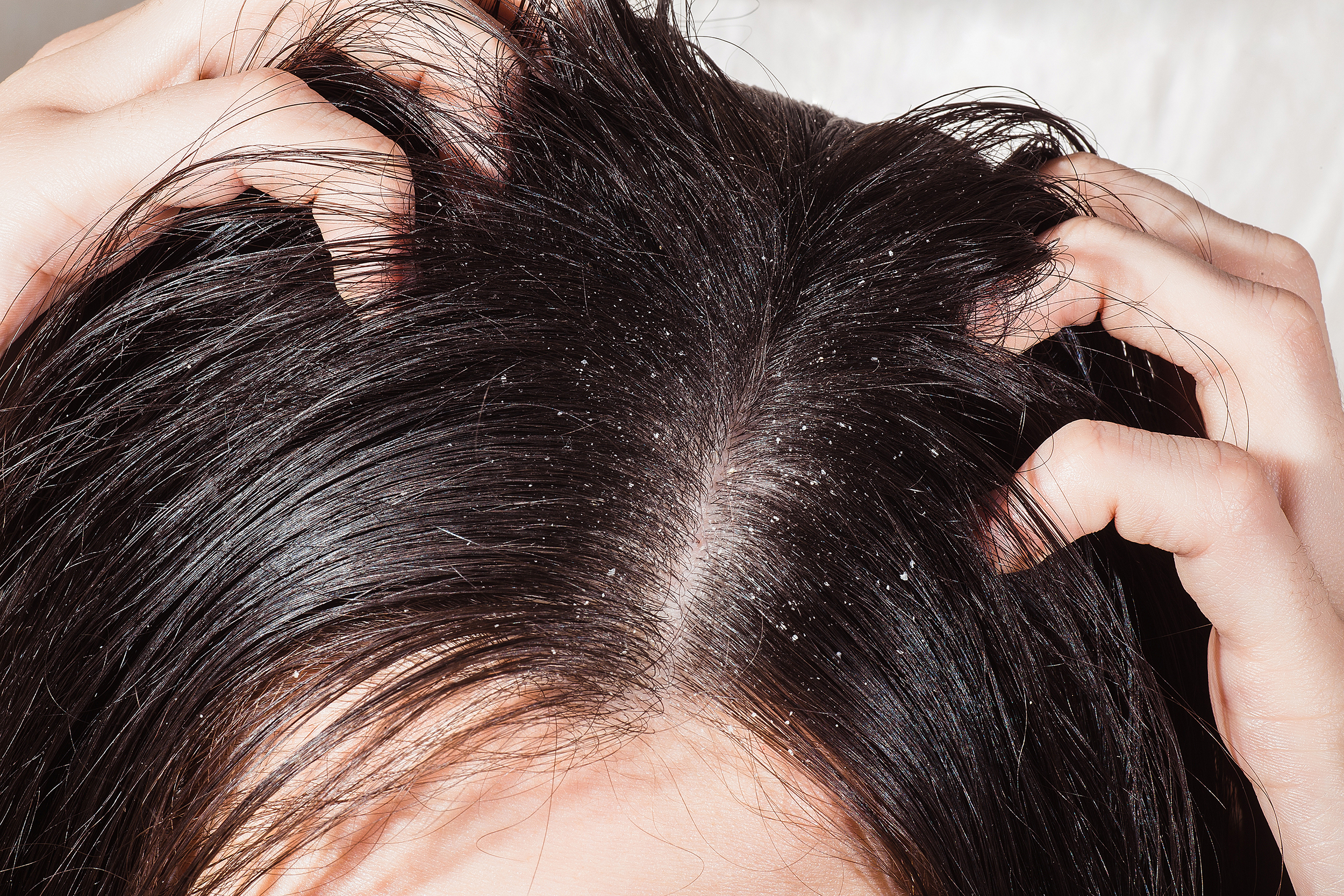 Может ли от краски матрикс выпадать волосы